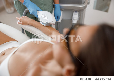 Closeup of hair removal procedure on arms with ipl machine from a professional cosmetologist 88345748