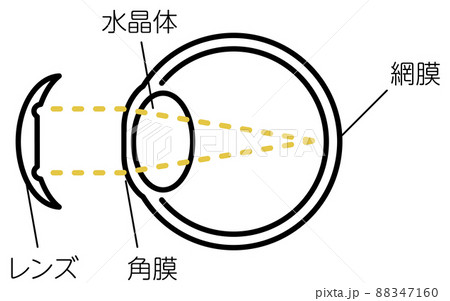 視力矯正レンズ、オルソケラトロジーレンズの図解（装用後） 88347160
