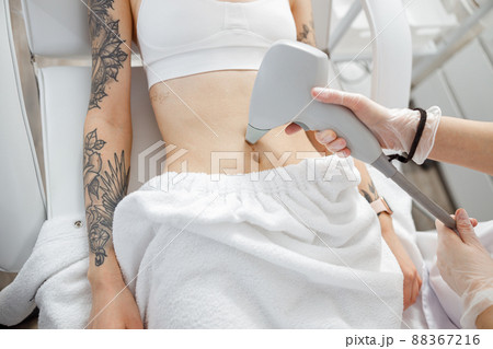 Young woman receiving abdominal laser treatment in beauty clinic Young woman receiving abdominal laser treatment in beauty clinic 88367216