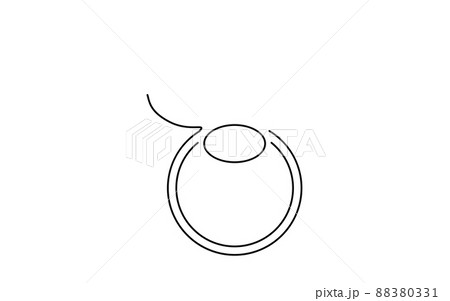 レーシック、屈折矯正手術のメディカルイラスト レーシック、屈折矯正手術のメディカルイラスト 88380331