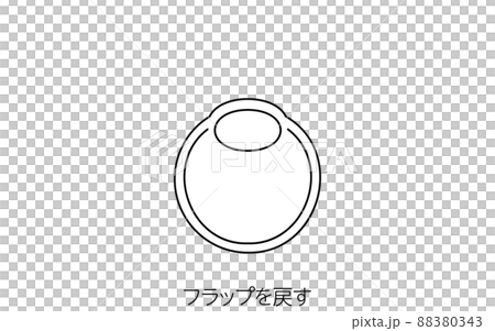 LASIK, Medical Illustration of Refractive Surgery 88380343