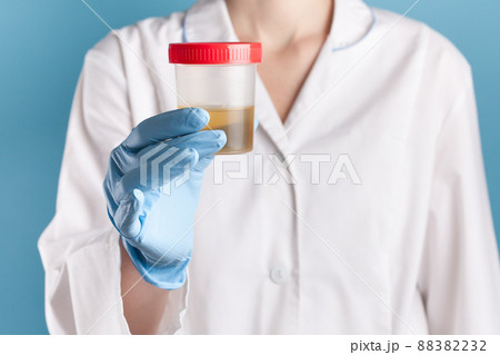 doctor in a white uniform and blue gloves on blue background holds plastic test jar with yellow urine. test for disease 88382232