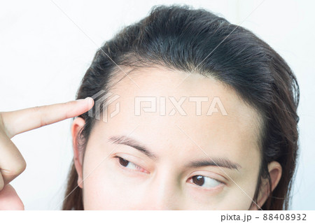 Woman serious hair loss problem for health care shampoo and beauty product concept, selective focus 88408932
