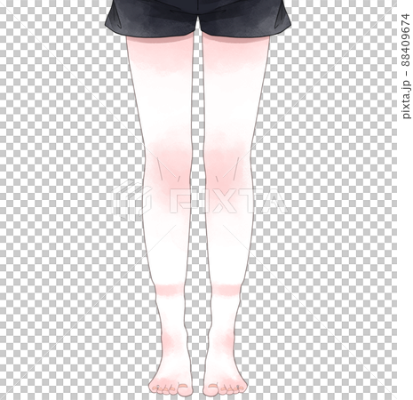 Fat woman's legs 88409674