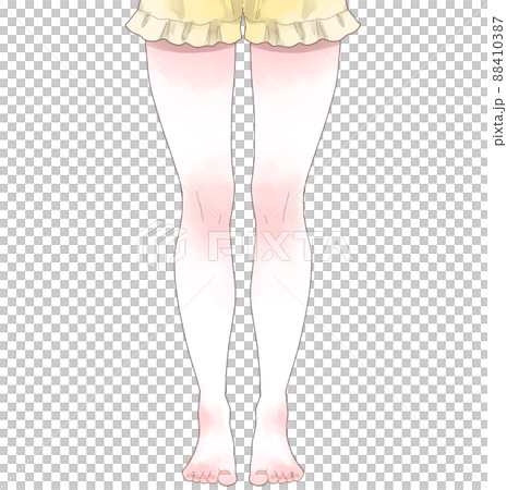 肌肉肥胖女人的腿 肌肉肥胖女人的腿 88410387