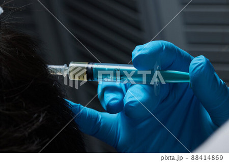 Injection plasma into head hair man cosmetologist doctor. 88414869