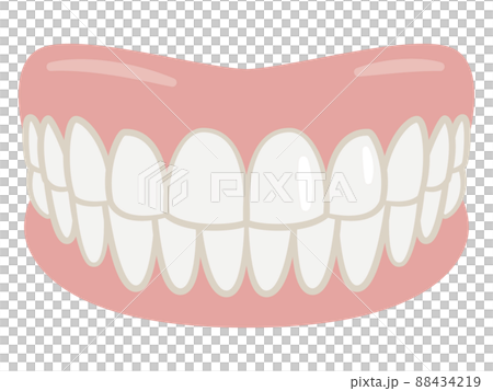 入れ歯のイラストレーション 88434219