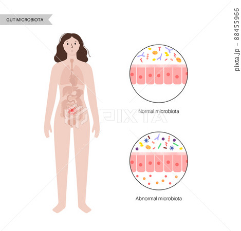 Human gut microbiota Human gut microbiota 88455966