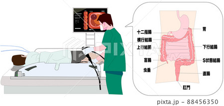 大腸内視鏡検査と内臓と大腸 88456350