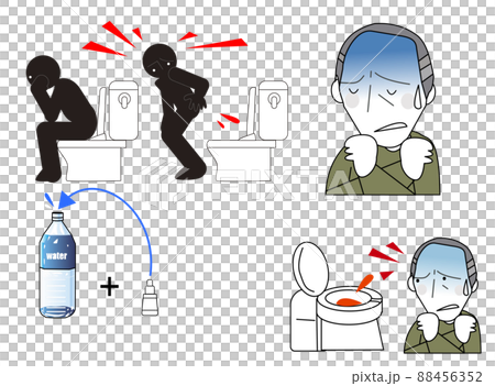 内視鏡で大腸からの出血の検査 内視鏡で大腸からの出血の検査 88456352
