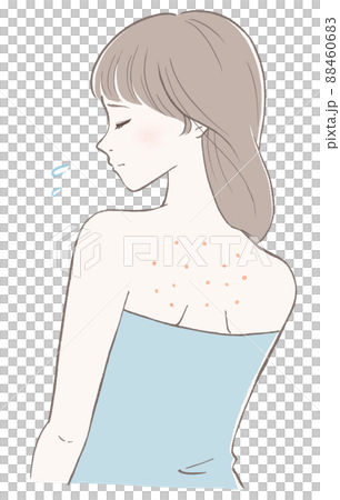 A black version of a line drawing of a woman who has a lump on her back A black version of a line drawing of a woman who has a lump on her back 88460683