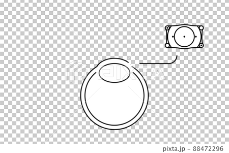 ICL(眼内コンタクトレンズ)手術、ICL挿入の図解 ICL(眼内コンタクトレンズ)手術、ICL挿入の図解 88472296