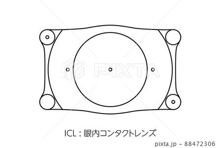 ICL、眼内コンタクトレンズ ICL、眼内コンタクトレンズ 88472306