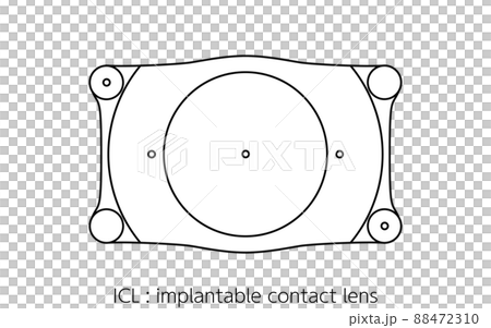 ICL, intraocular contact lenses ICL, intraocular contact lenses 88472310