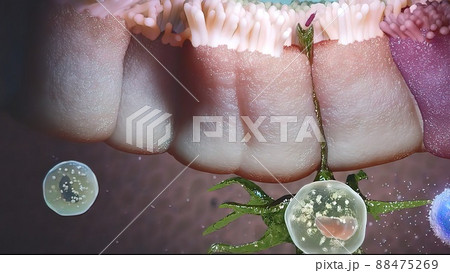 Bacteria attack the digestive system and disappear 88475269
