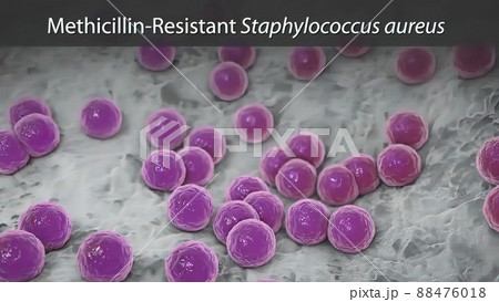 Bacteria infecting the body Bacteria infecting the body 88476018