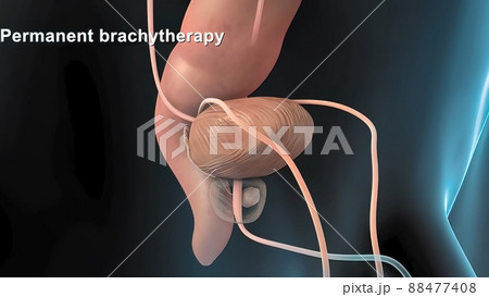 female-male digestive and reproductive system 88477408