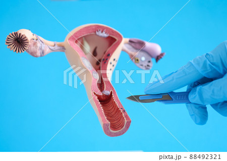 Female reproductive system anatomy uterus and scalpel closeup Female reproductive system anatomy uterus and scalpel closeup 88492321