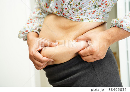 Overweight asian woman use hand to squeeze fat belly big size overweight and obesity. 88496835