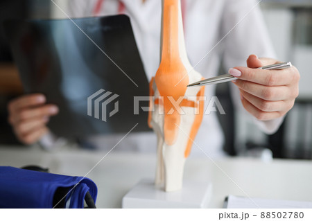 Doctor traumatologist examines x-ray and legs and the model of knee joint Doctor traumatologist examines x-ray and legs and the model of knee joint 88502780
