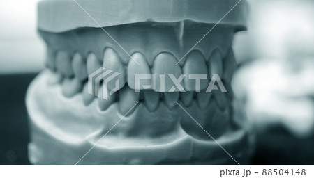 Upper and lower jaw of a man printed on a 3d printer of photopolymer Upper and lower jaw of a man printed on a 3d printer of photopolymer 88504148