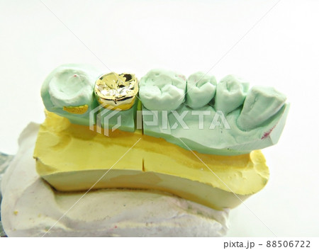 金歯 歯 歯科 88506722
