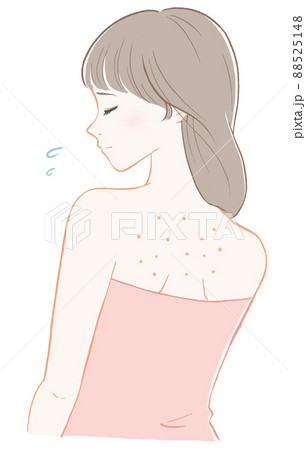 背中にぶつぶつが出来ている女性(ピンク) 88525148