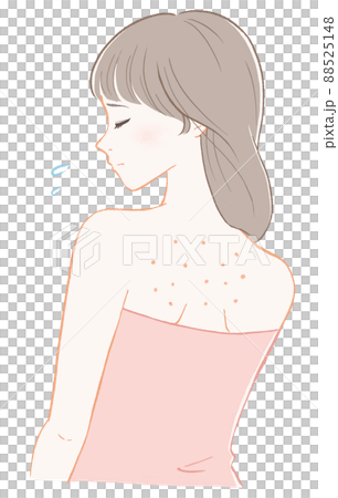 背中にぶつぶつが出来ている女性(ピンク) 88525148