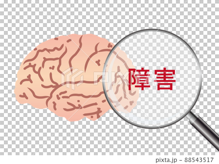 障害 88543517