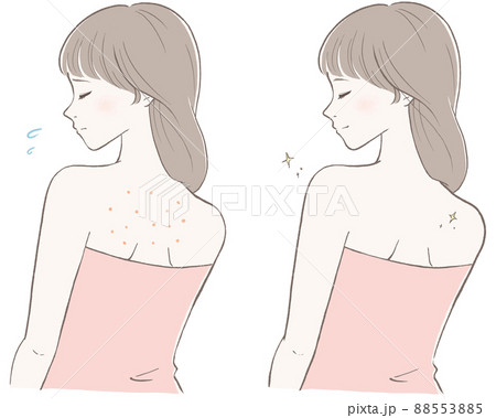 背中を気にする女性(ピンク)　ビフォーアフター　線画黒バージョン 88553885