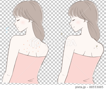 背中を気にする女性(ピンク)　ビフォーアフター　線画黒バージョン 88553885