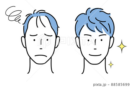 男性の頭部　薄毛に悩む　髪の毛が豊か 88585699