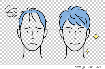 Men's head suffers from thinning hair, rich in hair Men's head suffers from thinning hair, rich in hair 88585699