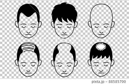 色々な薄毛タイプのイラストのセット 88585700