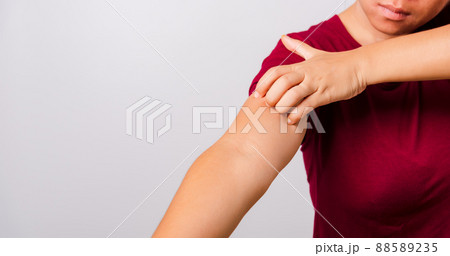 Asian beautiful woman itching her scratching her itchy arm Asian beautiful woman itching her scratching her itchy arm 88589235
