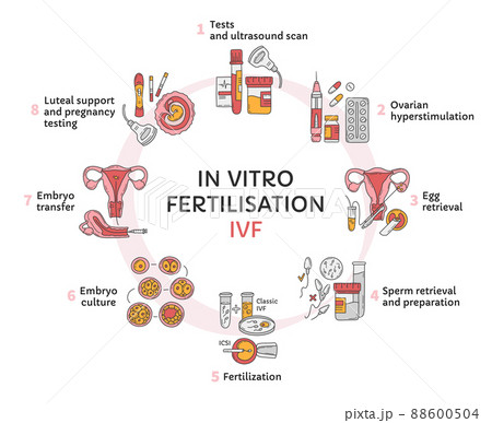 In Vitro fertilization IVF vector circle infographic and infertility treatment 88600504