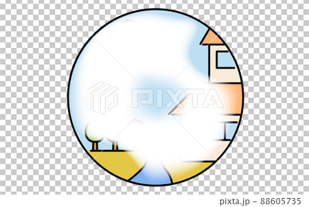 Illustrated glaucoma, changes in visual field... - Stock Illustration ...