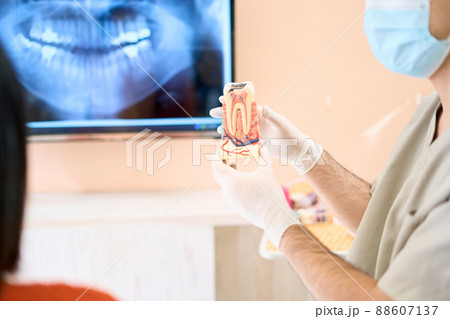 歯科医療イメージ 88607137