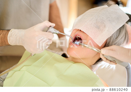 高齢者歯科治療イメージ 88610240