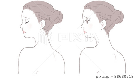 肌トラブルに悩む女性 肌トラブルに悩む女性 88680518
