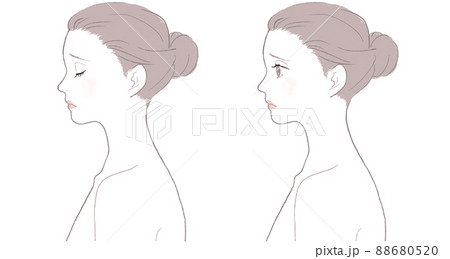 肌トラブルに悩む女性 88680520