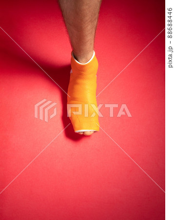 Foot with broken toe bone in orange fiberglass cast pink background. Injured fractured swollen male leg. Patient body. 88688446