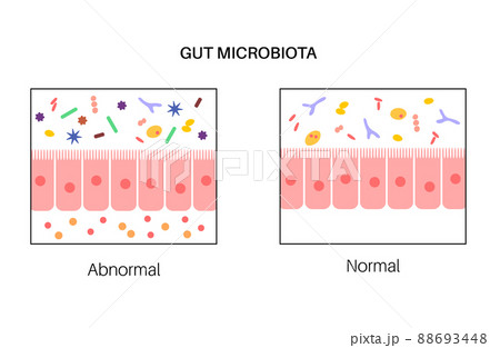 Human gut microbiota 88693448