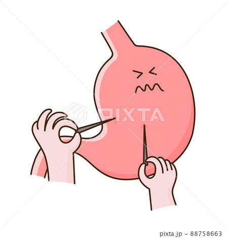 刺すような痛みのある胃のベクターイラスト。 刺すような痛みのある胃のベクターイラスト。 88758663