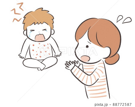 アトピーの痒みで大泣きする赤ちゃんと慌てるお母さん アトピーの痒みで大泣きする赤ちゃんと慌てるお母さん 88772587