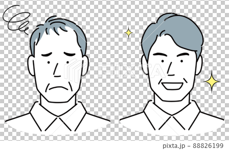 The head of a middle-aged man suffers from thinning hair. 88826199