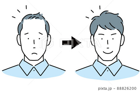 男性の頭部 薄毛に悩む 髪の毛が豊か 男性の頭部 薄毛に悩む 髪の毛が豊か 88826200