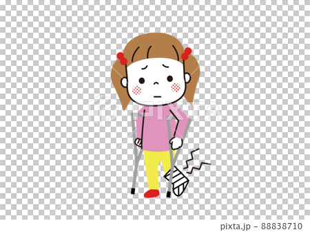 A girl with a broken leg, a cast and a crutch 88838710