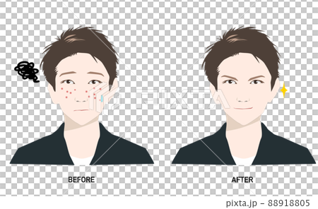 Before and After Men's Skin Care for Men Suffering from Acne __ 88918805