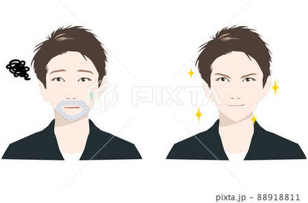 青髭に悩む男性ビフォーアフター__メンズスキンケア 88918811